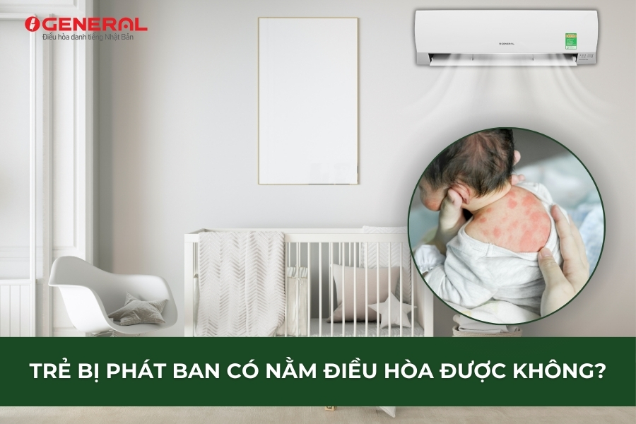 Trẻ Bị Phát Ban Có Nằm Điều Hòa Được Không?